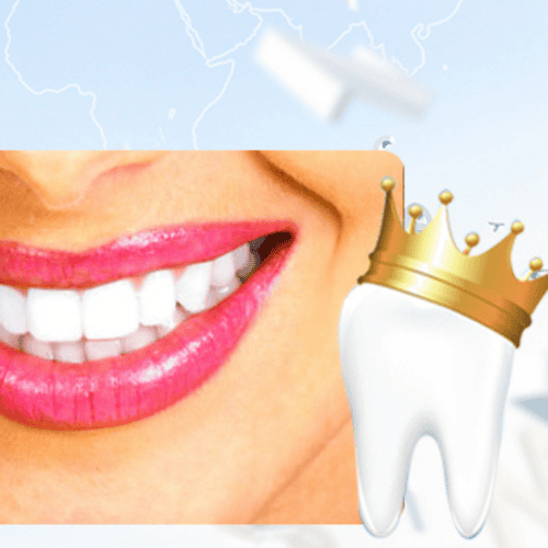 Learn About Dental Crowns in Tijuana, Mexico